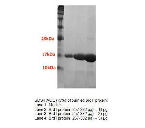 SDS-PAGE (15%) of purified BrdT protein:<br />Lane 1: Marker.<br />Lane 2: BrdT protein (257-382 aa) – 10  g<br />Lane 3: BrdT protein (257-382 aa) – 25  g<br />Lane 4: BrdT protein (257-382 aa) – 50  g
