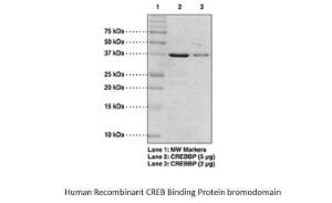 Human Recombinant Creb Bp Brd 1081-1197 aa H (from <i>E. coli</i>)