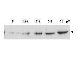 Antibody (RAB)CHK2 PT68 100 µg