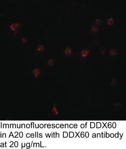 Anti-DDX60 Rabbit Polyclonal Antibody