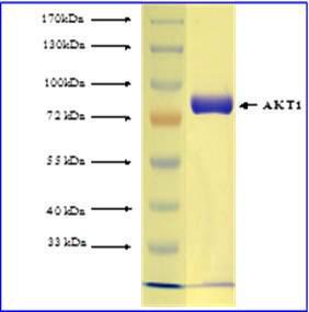Human Recombinant AKT1 active (from Baculovirus (Sf9 Insect cells))