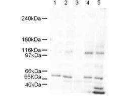 SMARCAL1 antibody (rabbit) 1 µg