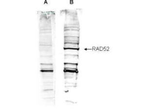Antibody RAD52 (rabbit) 100 µg