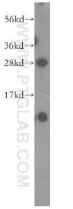 Anti-NIPSNAP3B Rabbit Polyclonal Antibody