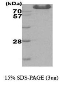 Human Recombinant Hexokinase Type III (from <i>E. coli</i>)