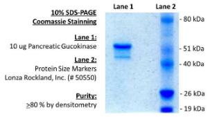 10% SDS-PAGE gel Lane 1. 10 µg Pancreatic glucokinase.Lane 2. Protein MW marker.