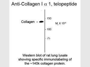 Collagen 1 alpha 1 telopeptide