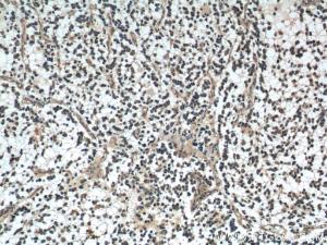 Anti-DKK1 Rabbit Polyclonal Antibody