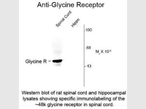 Glycine receptor antibody 200