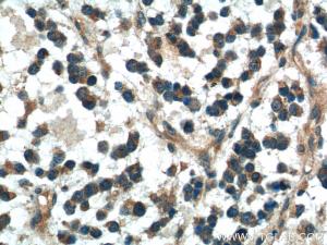 Anti-DKK1 Rabbit Polyclonal Antibody