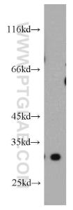 Anti-DKK1 Rabbit Polyclonal Antibody