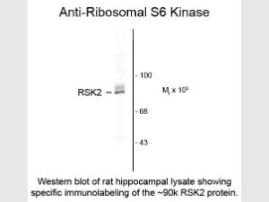P90 RSK1 antibody 100 µl