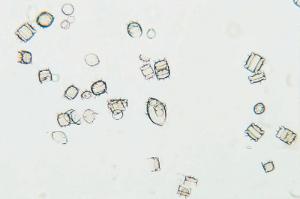 Recent Marine Diatoms Slide