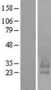 C16orf79 Overexpression Lysate (Adult Normal), Novus Biologicals (NBL1-08228)