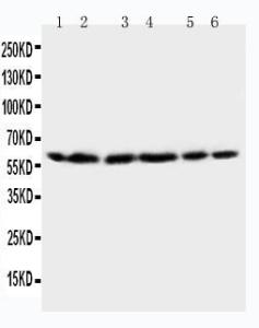 Anti-HSP60 Rabbit Polyclonal Antibody