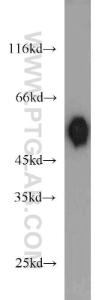 Anti-DLK1 Rabbit Polyclonal Antibody