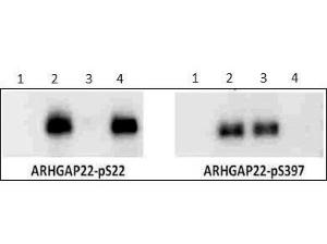 ARHGAP22 PS22 antibody 50 µg