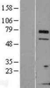TCTN3 Overexpression Lysate (Adult Normal), Novus Biologicals (NBL1-16796)