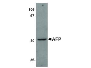 AFP antibody 100 μg