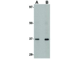 AIPL1 C-Term antibody 100 μg
