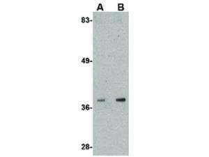 ALDH3A2 antibody 100 μg