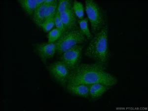 Anti-TRK fused gene Rabbit Polyclonal Antibody