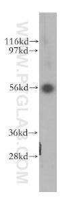 Anti-TRK fused gene Rabbit Polyclonal Antibody