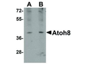 ATOH8 antibody 100 μg