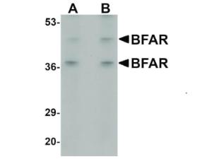 BFAR antibody 100 μg