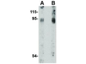 BICD2 antibody C-Term 100 μg