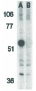 CASPASE-12 antibody 100 μg