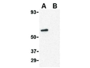 CRTH2 antibody N-TERM 100 μg