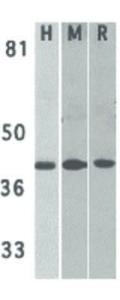 DAPK2 antibody 100 μg