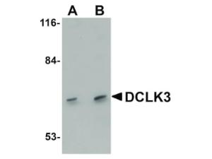DCLK3 antibody 100 μg