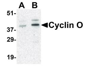 Cyclin O antibody 100 μg