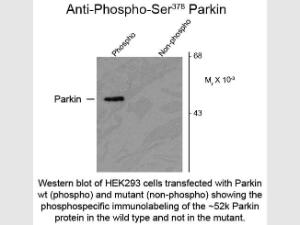 Parkin phospho S378 antibody 1