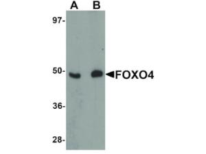 FOXO4 N-TERM antibody 100 μg