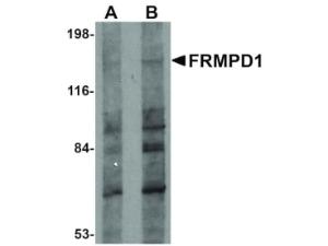 FRMPD1 antibody 100 μg