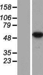 DDX47 Lysate (Adult Normal), Novus Biologicals (NBP2-07049)