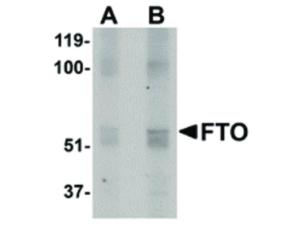 FTO antibody 100 μg