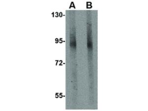 GLE1 C-Term antibody 100 μg