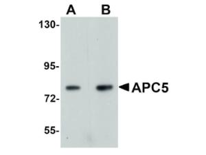 APC5 antibody 100 μg