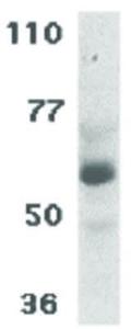 CIKS antibody C-Term 100 μg