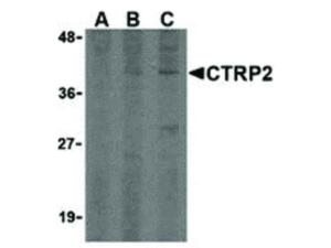 CTRP2 antibody 100 μg