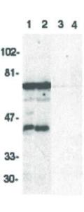 DRAK2 antibody 100 μg