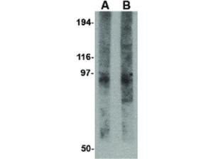 EVER2 antibody N-TERM 100 μg