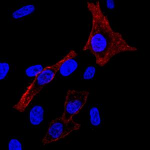 Surface labeling of live HeLa cells with CF594-conjugated cholera toxin B subunit (red). Nuclei are stained with DAPI (blue)
