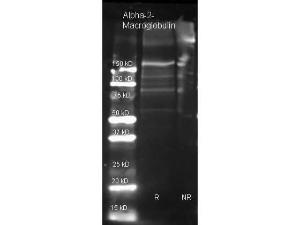 A2M antibody Biotin 25 μl