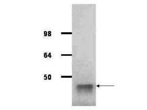 Aldolase antibody HRP 25 μl