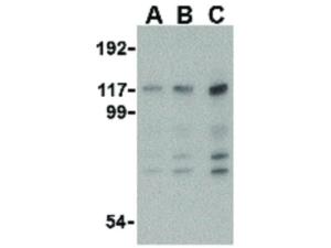 ANTI-MDA5 (RB) antibody 100 µg